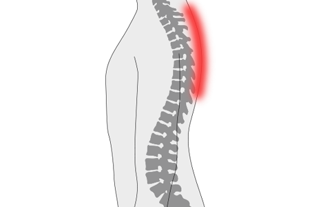 dolor de espalda alta